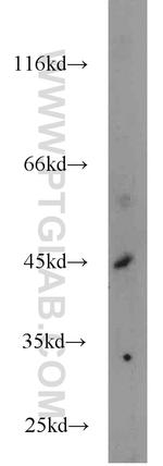 PANK1 Antibody in Western Blot (WB)