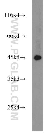 PANK1 Antibody in Western Blot (WB)