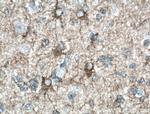 SEPT8 Antibody in Immunohistochemistry (Paraffin) (IHC (P))