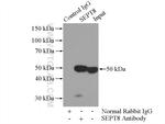 SEPT8 Antibody in Immunoprecipitation (IP)