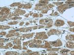 ITLN1 Antibody in Immunohistochemistry (Paraffin) (IHC (P))