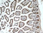 ITLN1 Antibody in Immunohistochemistry (Paraffin) (IHC (P))