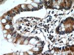 ITLN1 Antibody in Immunohistochemistry (Paraffin) (IHC (P))