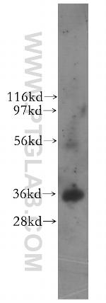 ITLN1 Antibody in Western Blot (WB)