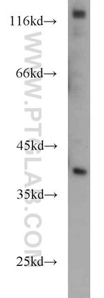 ITLN1 Antibody in Western Blot (WB)