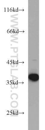 ITLN1 Antibody in Western Blot (WB)