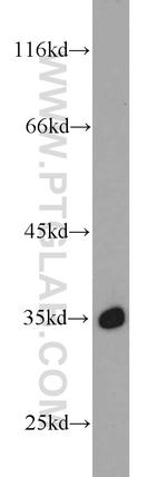 ITLN1 Antibody in Western Blot (WB)
