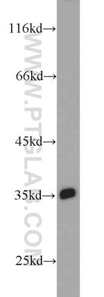 ITLN1 Antibody in Western Blot (WB)