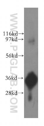 ITLN1 Antibody in Western Blot (WB)