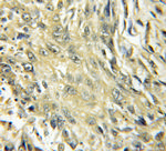 CYP4B1 Antibody in Immunohistochemistry (Paraffin) (IHC (P))