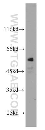 CYP4B1 Antibody in Western Blot (WB)