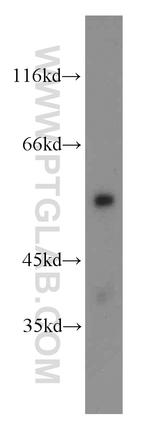 CYP4B1 Antibody in Western Blot (WB)