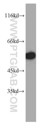 CYP4B1 Antibody in Western Blot (WB)