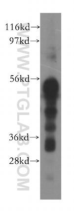 SFRS6 Antibody in Western Blot (WB)