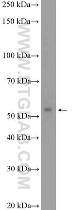 SFRS6 Antibody in Western Blot (WB)