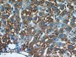 RBP4 Antibody in Immunohistochemistry (Paraffin) (IHC (P))