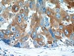RBP4 Antibody in Immunohistochemistry (Paraffin) (IHC (P))
