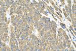 RBP4 Antibody in Immunohistochemistry (Paraffin) (IHC (P))