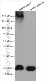 RBP4 Antibody in Western Blot (WB)