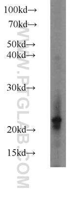 RBP4 Antibody in Western Blot (WB)