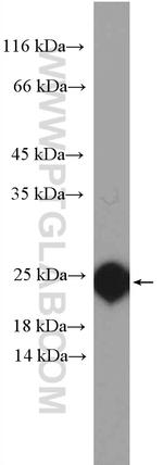 RBP4 Antibody in Western Blot (WB)
