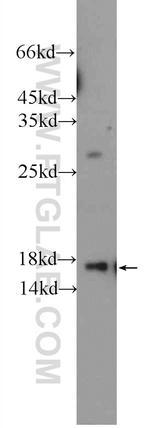 RBP4 Antibody in Western Blot (WB)