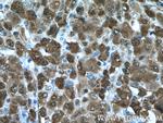 NAMPT/PBEF Antibody in Immunohistochemistry (Paraffin) (IHC (P))