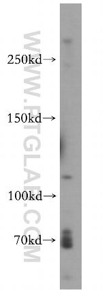 VWF/VWFpp Antibody in Western Blot (WB)