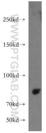 VWF/VWFpp Antibody in Western Blot (WB)
