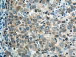 PTPN22 Antibody in Immunohistochemistry (Paraffin) (IHC (P))