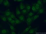 PRIM2 Antibody in Immunocytochemistry (ICC/IF)
