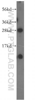 NIPSNAP3B Antibody in Western Blot (WB)