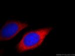 TREM1 Antibody in Immunocytochemistry (ICC/IF)