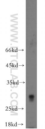 TREM1 Antibody in Western Blot (WB)