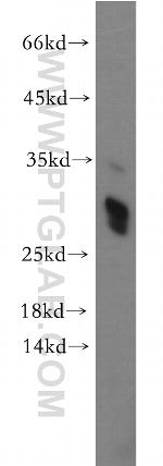 TREM1 Antibody in Western Blot (WB)