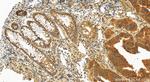 BET1 Antibody in Immunohistochemistry (Paraffin) (IHC (P))