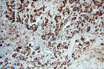 TPD52L2 Antibody in Immunohistochemistry (Paraffin) (IHC (P))