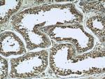 TPD52L2 Antibody in Immunohistochemistry (Paraffin) (IHC (P))
