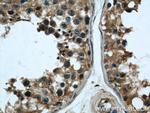 TPD52L2 Antibody in Immunohistochemistry (Paraffin) (IHC (P))