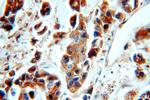 TPD52L2 Antibody in Immunohistochemistry (Paraffin) (IHC (P))