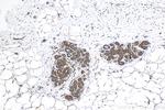 TPD52L2 Antibody in Immunohistochemistry (Paraffin) (IHC (P))