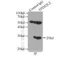 TPD52L2 Antibody in Immunoprecipitation (IP)