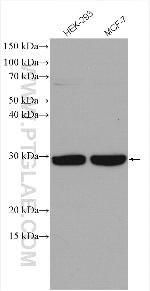 TPD52L2 Antibody in Western Blot (WB)
