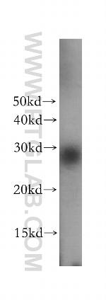 TPD52L2 Antibody in Western Blot (WB)