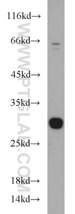 TPD52L2 Antibody in Western Blot (WB)