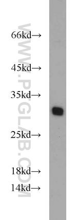 TPD52L2 Antibody in Western Blot (WB)