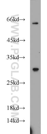 TPD52L2 Antibody in Western Blot (WB)
