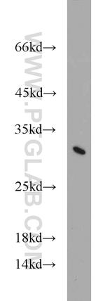 TPD52L2 Antibody in Western Blot (WB)