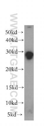 TPD52L2 Antibody in Western Blot (WB)
