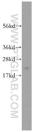 TPD52L2 Antibody in Western Blot (WB)